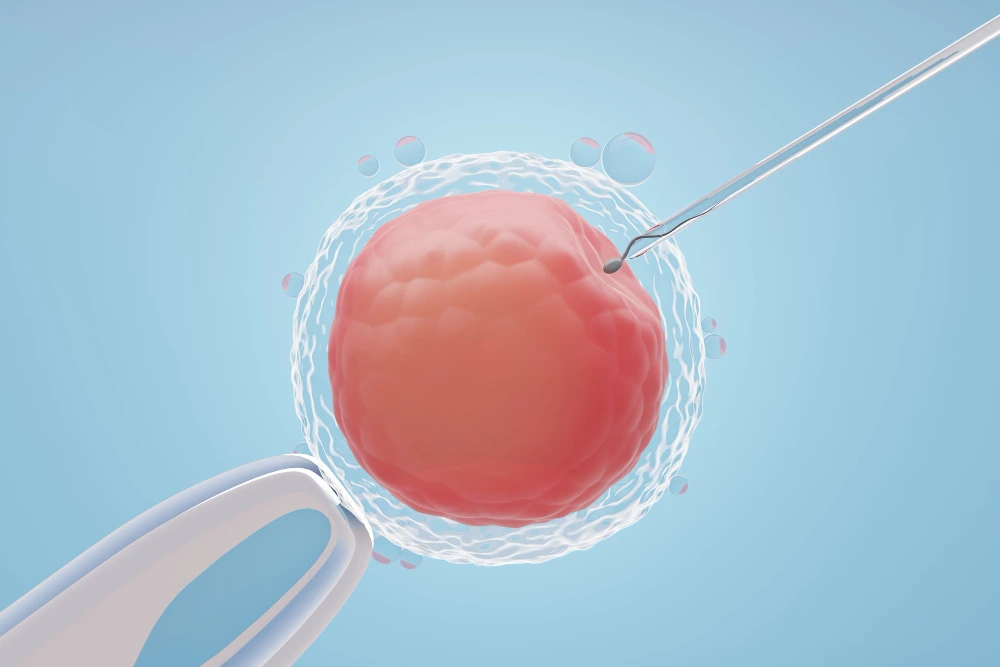 ICSI (Intracytoplasmic Sperm Injection)